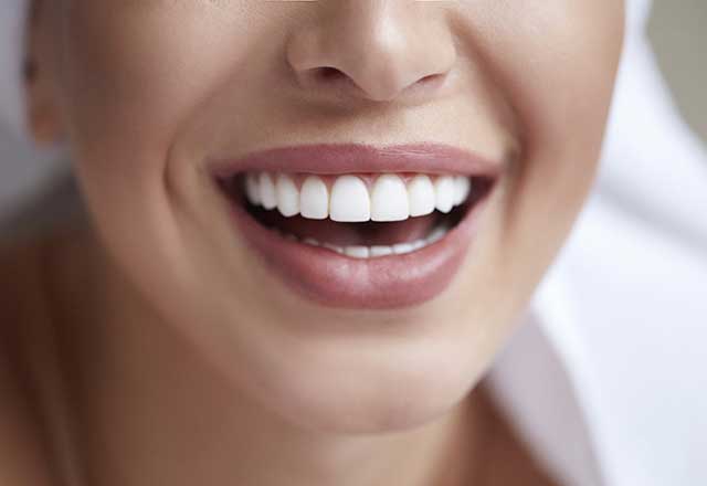 smile showing woman's teeth