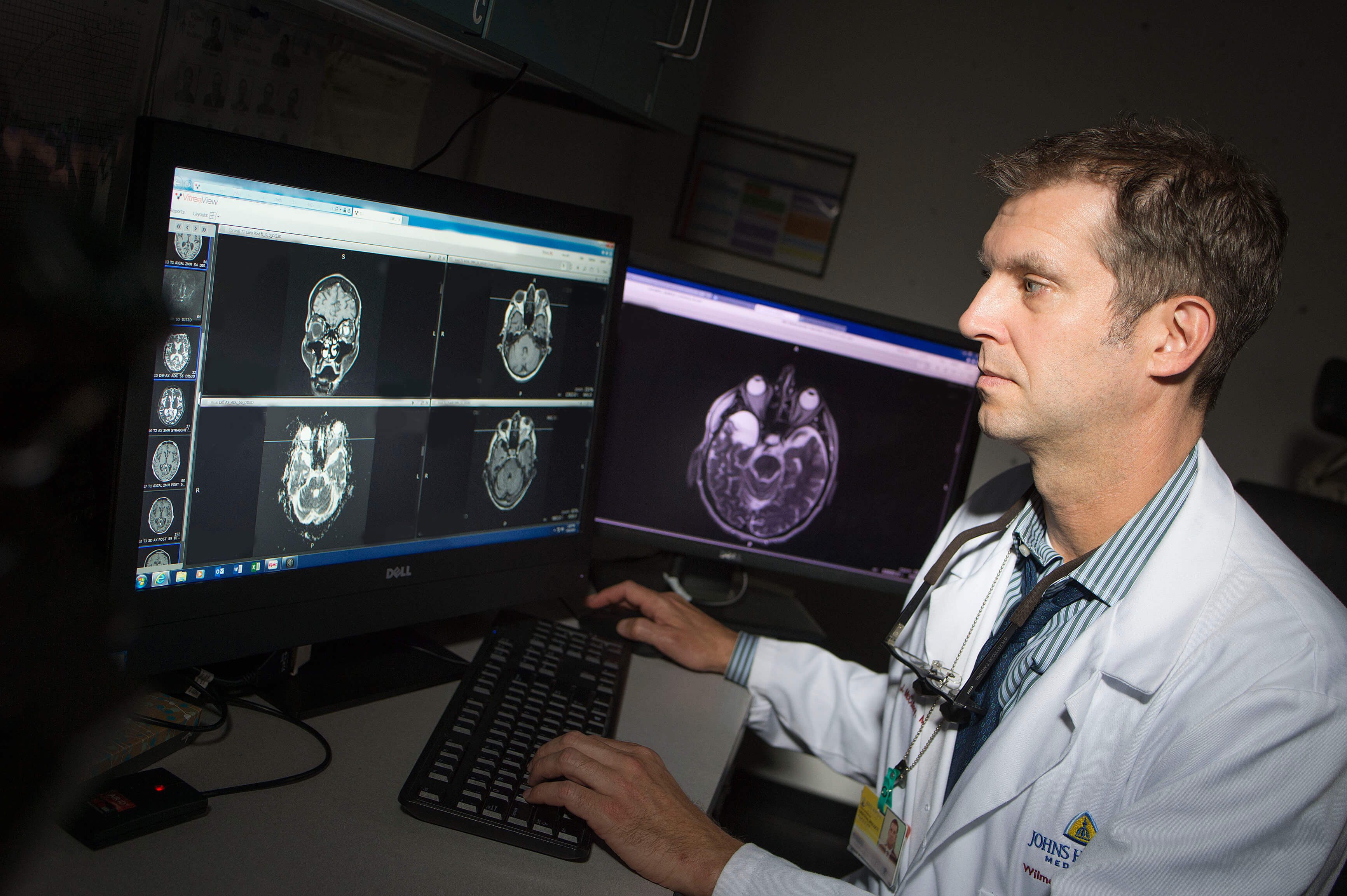 Current Research in NeuroOphthalmology