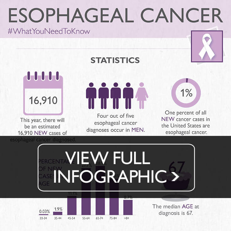 Esophageal Cancer Johns Hopkins Medicine Health Library