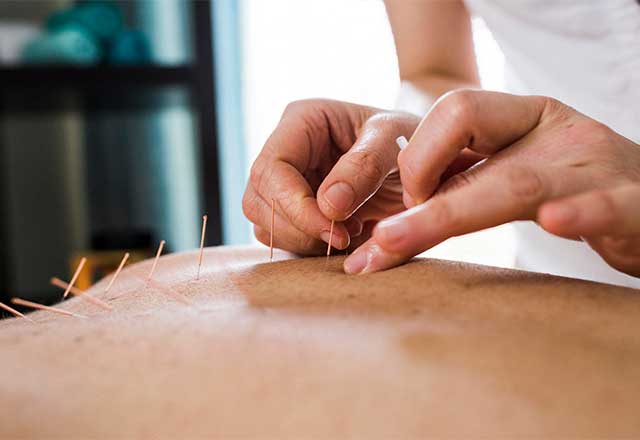 Acupuncture and Chinese Medicine Clinic Johns Hopkins