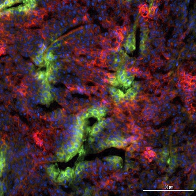 Sort, Color, Analyze | Johns Hopkins Medicine