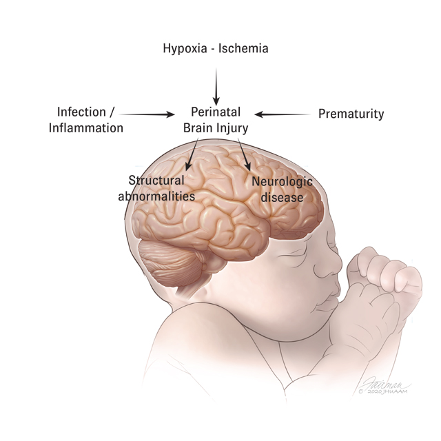 COVID-19 in pregnancy: implications for fetal brain development