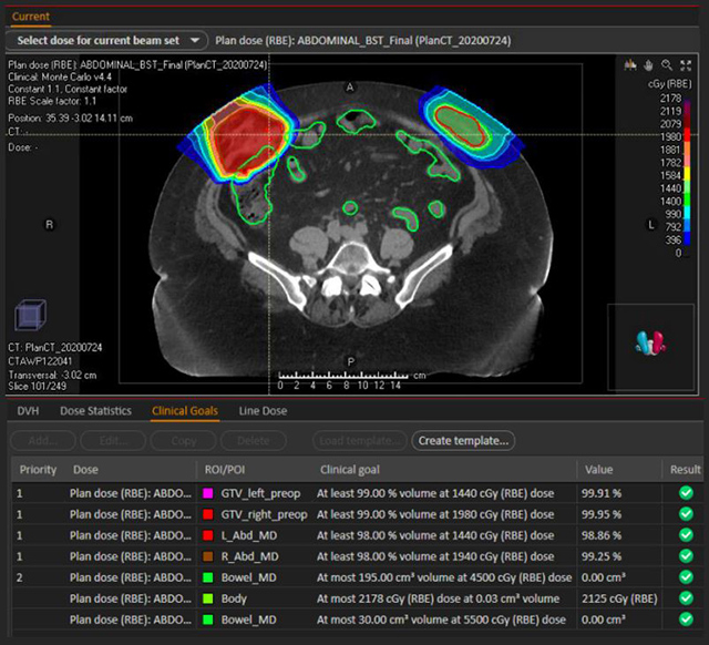 proton therapy boost plan