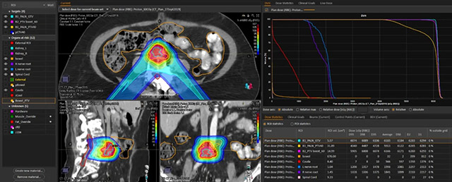 proton therapy case study 2