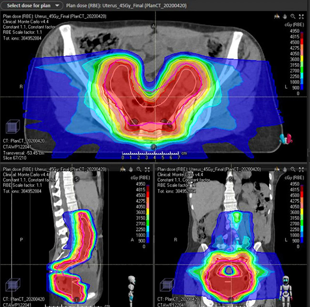 gyn case study 1