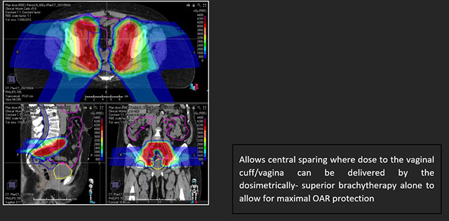 radiation field