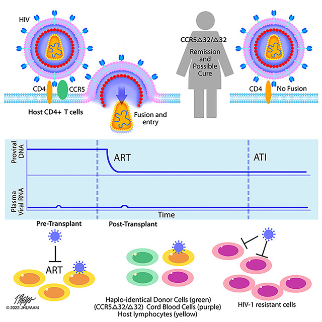 Graphic for Study Finds First Woman Possibly Cured of HIV