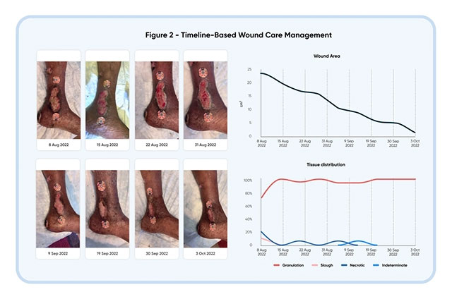 timeline-based wound care management