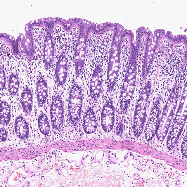 An image of gastrointestinal mucosa