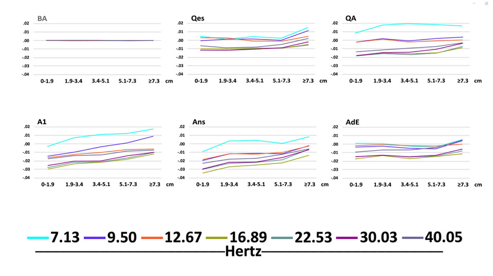 evaluation of intractable seizures and had undergone clinical stimulation testing