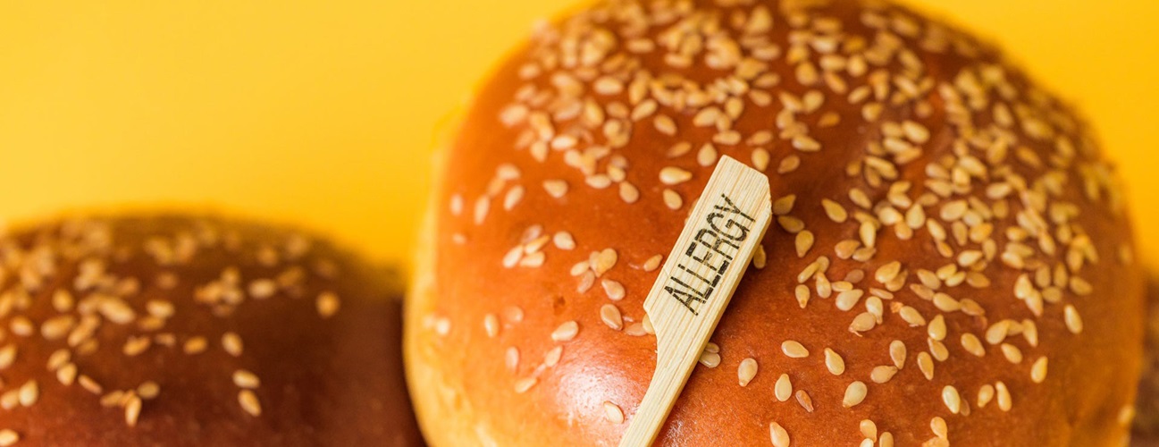 Hamburger buns labeled with an allergy sign