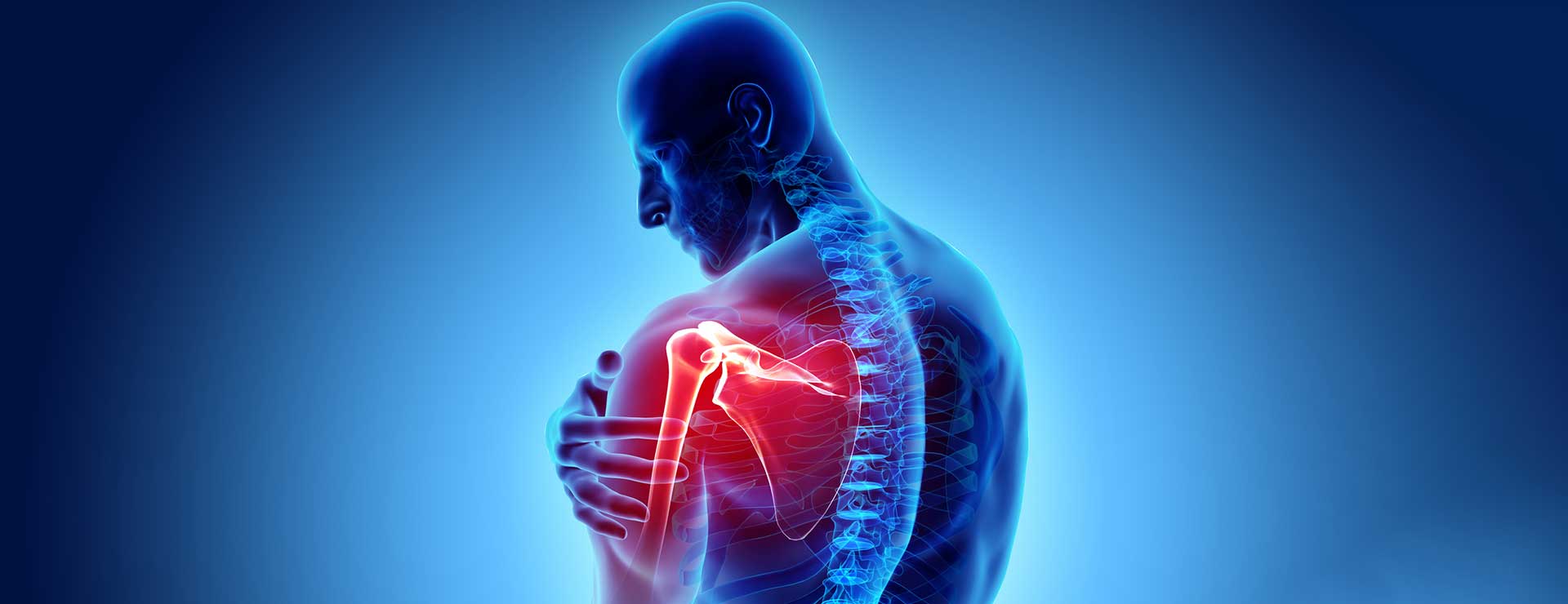 Signs symptoms of torn deals rotator cuff