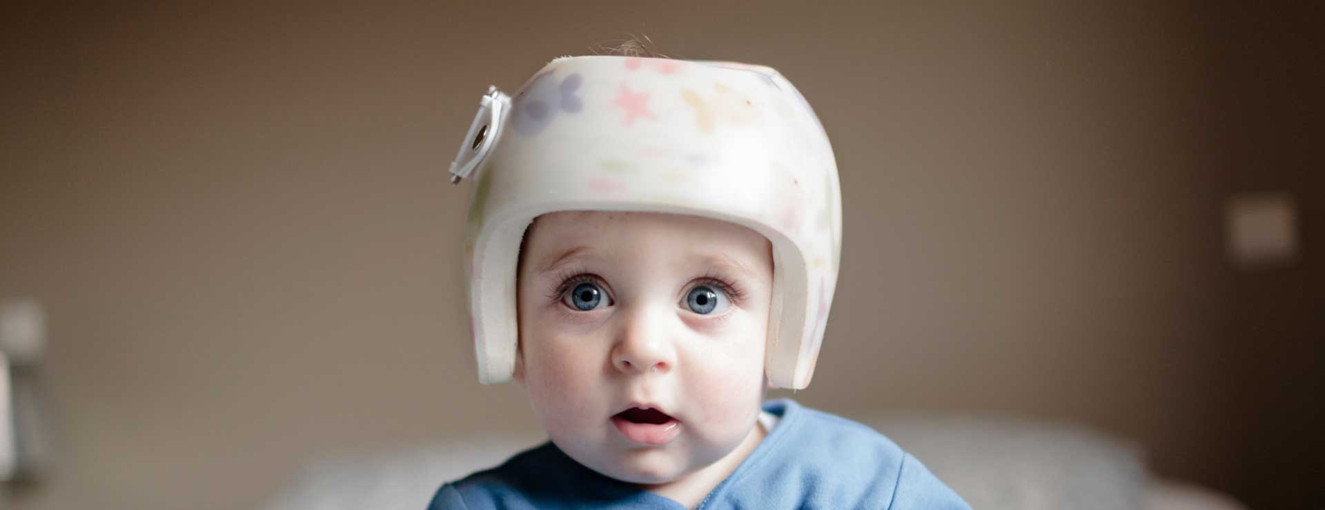 Babies heads sale that need helmets