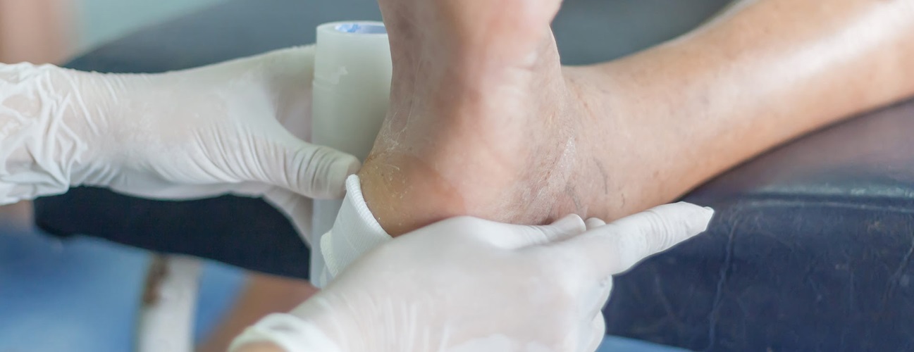 Foot ulcer being cleaned and treated in a doctors office