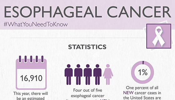 Esophageal Cancer Treatment | Johns Hopkins Medicine