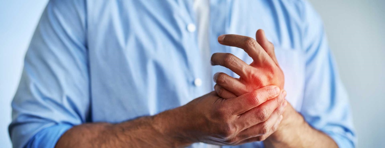 Capsulitis and Synovitis Climbing - Swelling of the Fingers - The Climbing  Doctor