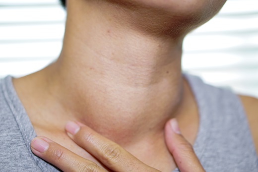 very swollen lymph nodes in neck