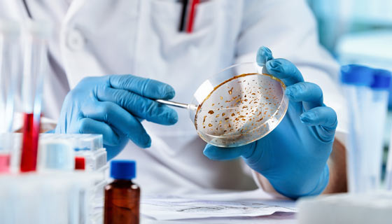 Researcher checking a petri dish