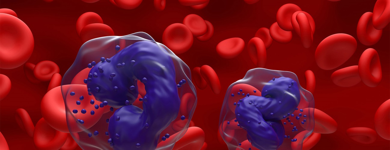 Digital illustration of myelogenous leukemia cells i the blood stream.