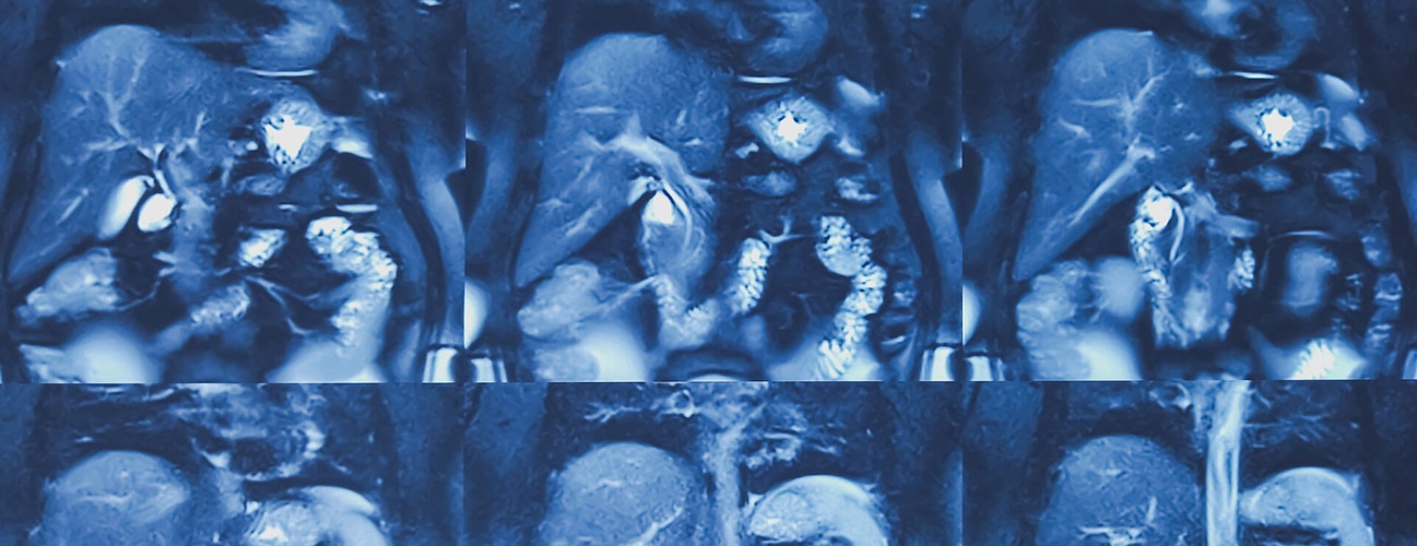 MRI image of abdomen
