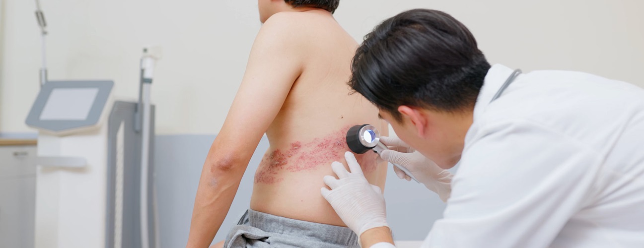 Doctor examining a patient with shingles
