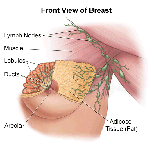 Figure of the pregnant woman with bilateral breast cancer.