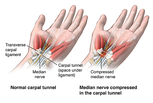 What is the Carpal Tunnel?, Wrist Tendons