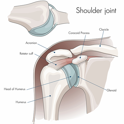 Top Tips for Shoulder Surgery - Move it or Lose it