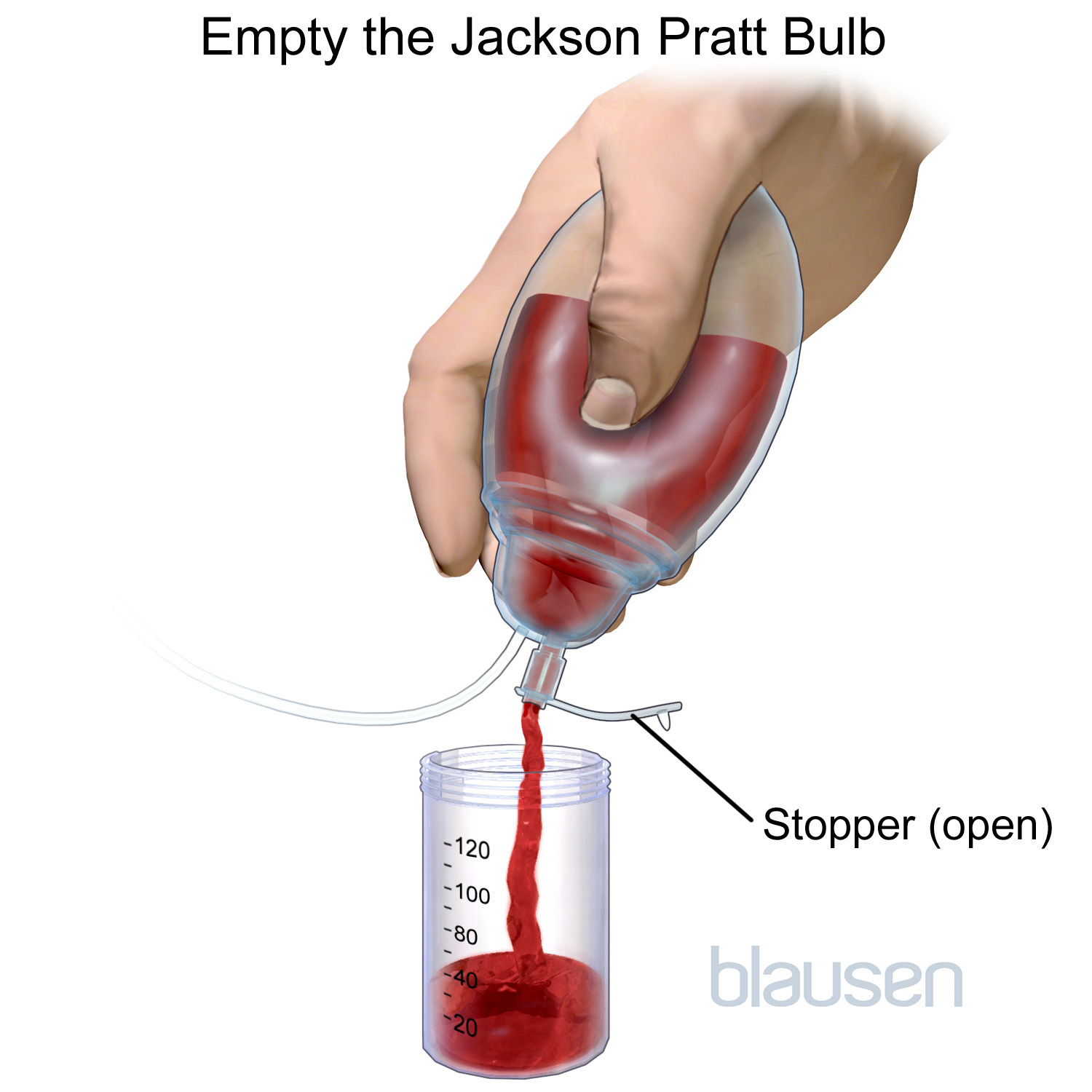 A graphic showing how to empty a Jackson-Pratt drain.