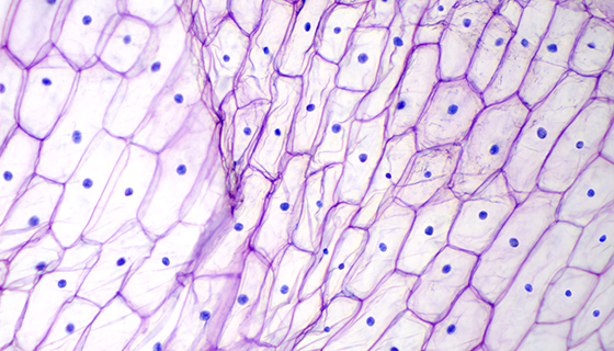 Cytology | Johns Hopkins Medicine