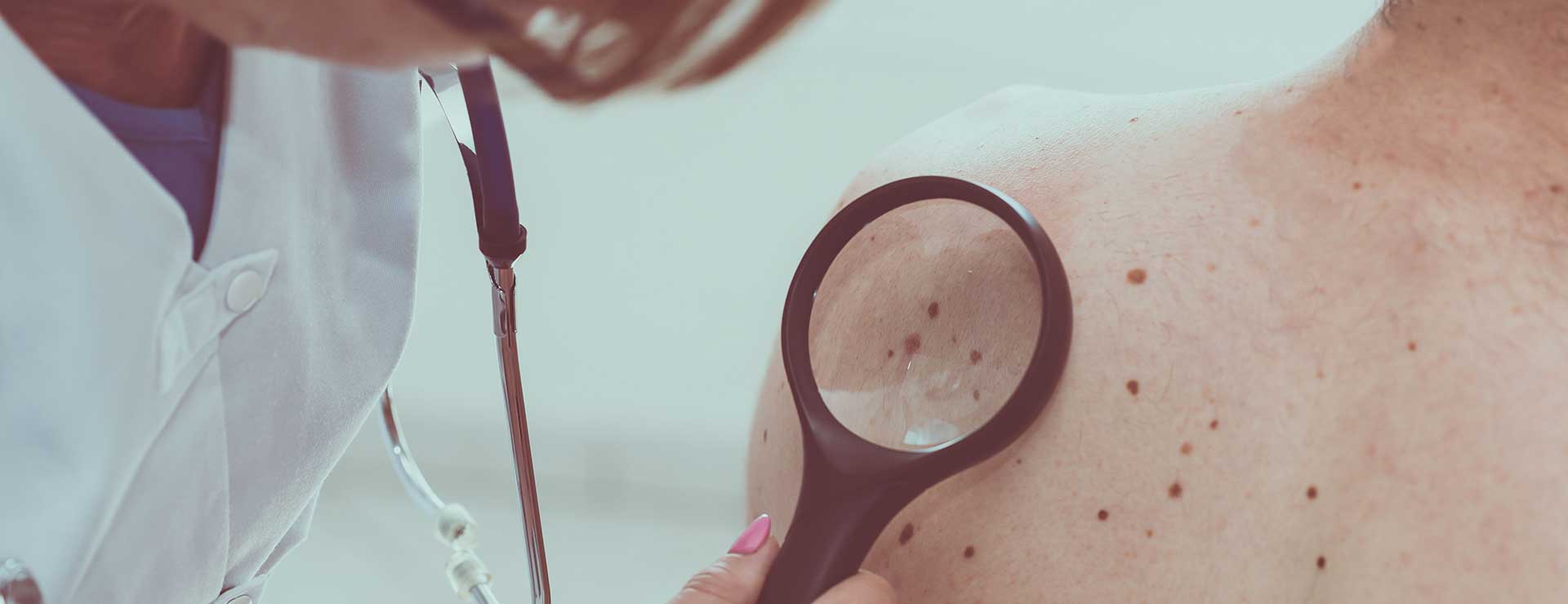 Surgery For Skin Cancer | Johns Hopkins Medicine