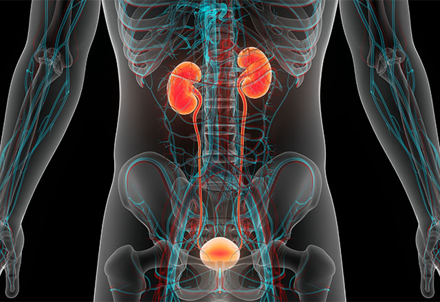 Cystography | Johns Hopkins Medicine