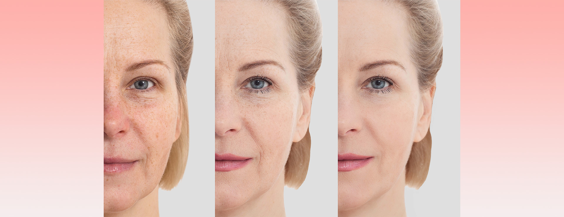 How Facial Rejuvenation Procedures Can Improve Aging Skin Johns