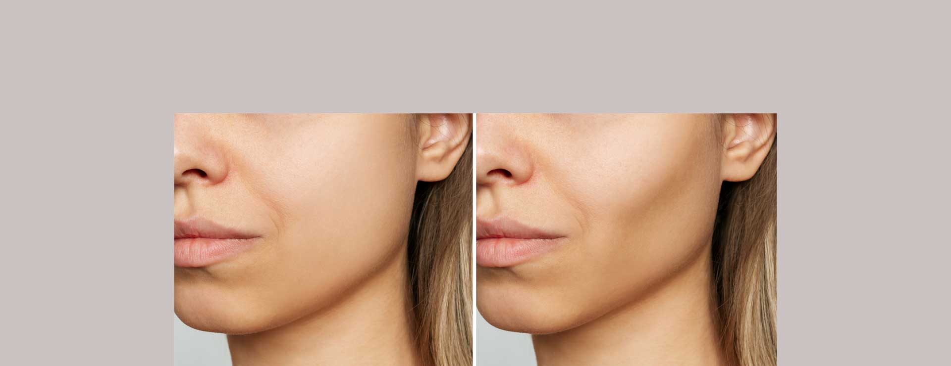 How to lose face and discount neck fat in a week