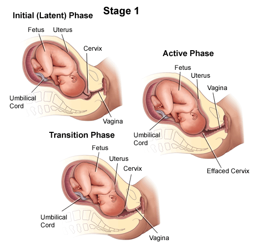 stages of labor dilation