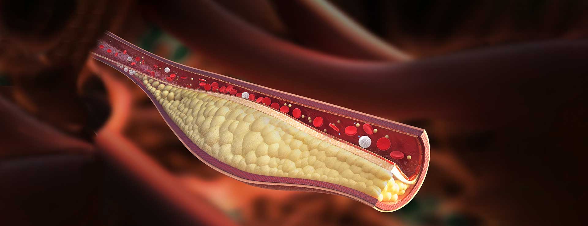 Cholesterol: 5 Truths To Know | Johns Hopkins Medicine