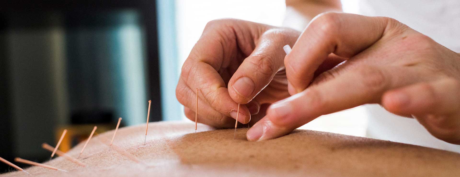 Acupuncture Johns Hopkins Medicine