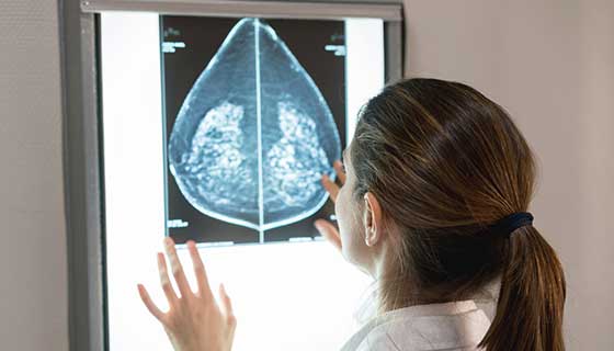 Understanding Your Mammogram Report