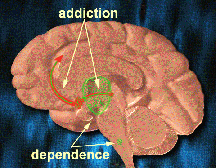 effects of drug addiction on the brain