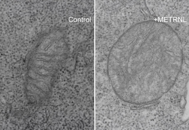 Meteorin-Like Protein