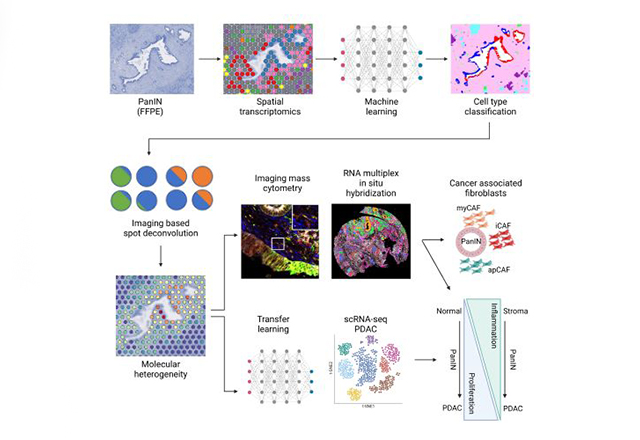 novel computational pipeline developed by Johns Hopkins Kimmel Cancer Researchers to identify early molecular and cellular progression to pancreatic ductal adenocarcinoma.