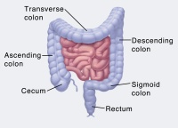 loop colostomy reversal