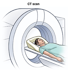  CT-Scan