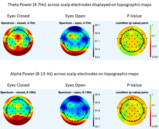 Theta Power (4-7Hz) across scalp electrodes displayed on topographic maps