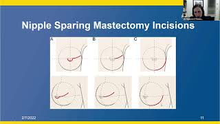 PowerPoint slide of mastectomy incisions 
