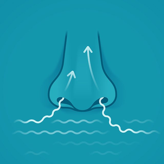 nasal polyps prevention
