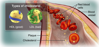 Liver health and cholesterol levels
