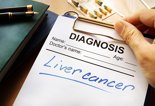 treating-colon-cancer-that-has-spread-to-the-liver-a-team-approach