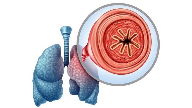 Study: Self-Management Program for Patients with COPD Boosts Quality of ...