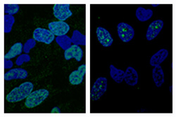 drug stops cell replication in low oxygen